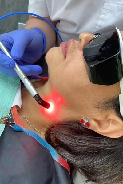 tratamiento laser chile